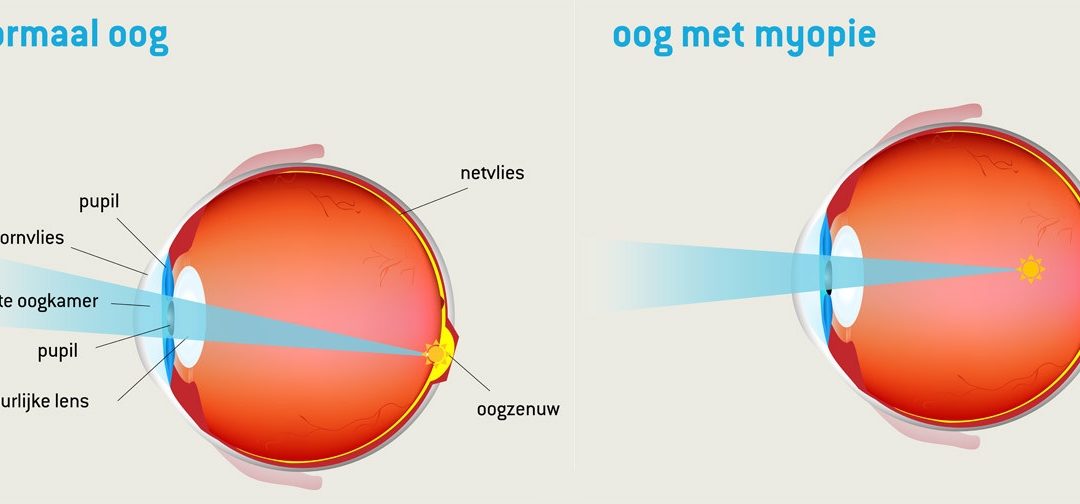 De gevolgen van opvoeden met teveel scherm- en social media gebruik.